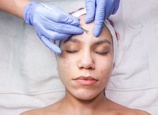 Sebum ve Akne İlişkisi: Tıkalı Gözenekler Nasıl Oluşur?