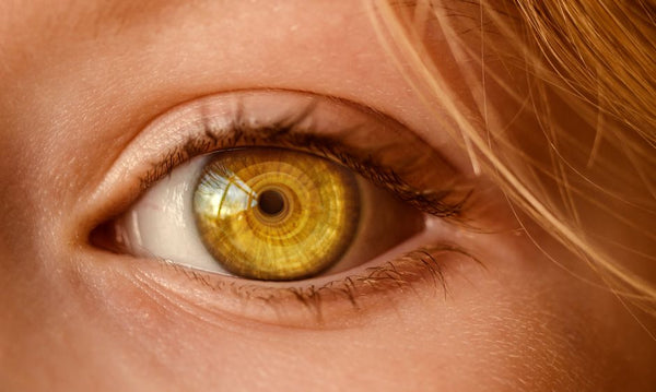 Yüksek Kolesterol Ciltte Belirti Verir mi? Xanthelasma ve Ge | CIRÈLL