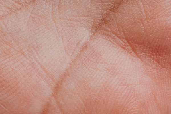 Biomimetic TriBarrier Klinik Çalışmalar