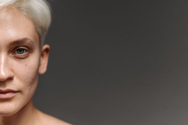 Patch Test Nasıl Yapılır? Bariyer Güvenliği İçin Adım Adım